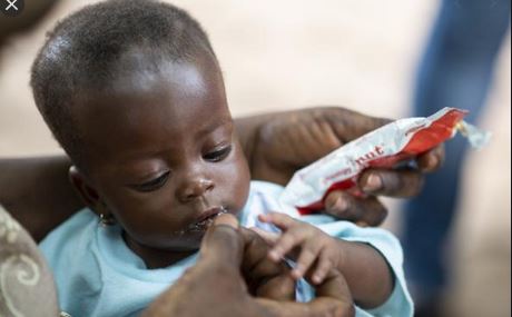 Congo-Ignié : au secours aux enfants souffrants de malformation congénitale