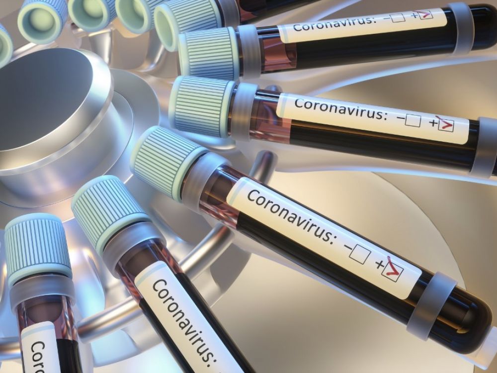 Coronavirus : le Congo reçoit 6 tonnes de médicaments