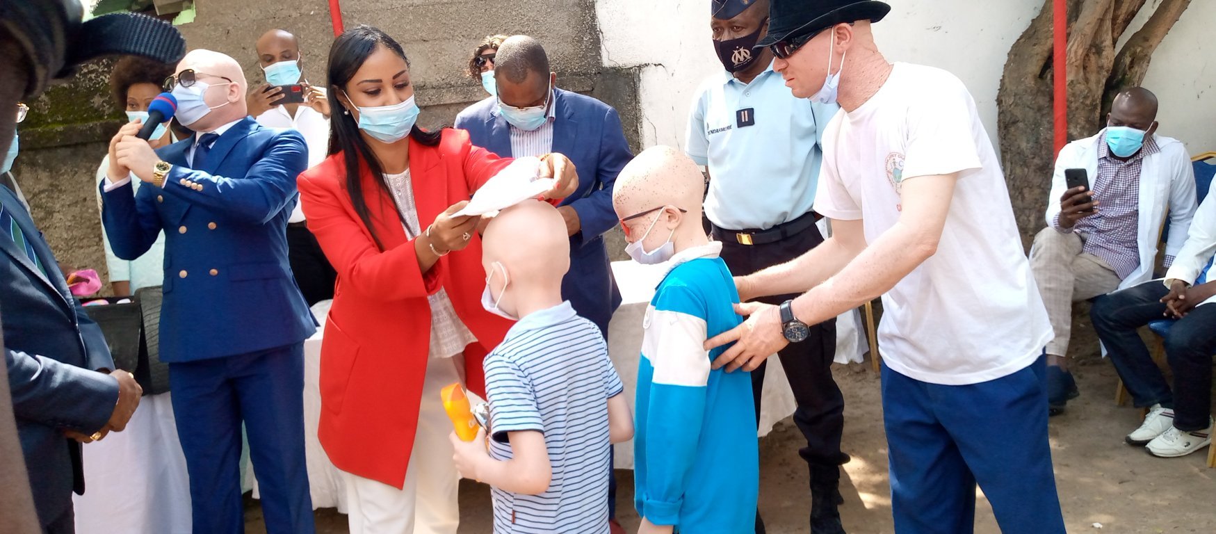 Congo : les albinos demandent au gouvernement la création des cliniques spécialisées