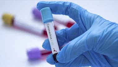 100 cas positifs de coronavirus détectés chaque jour. journaldebrazza.com