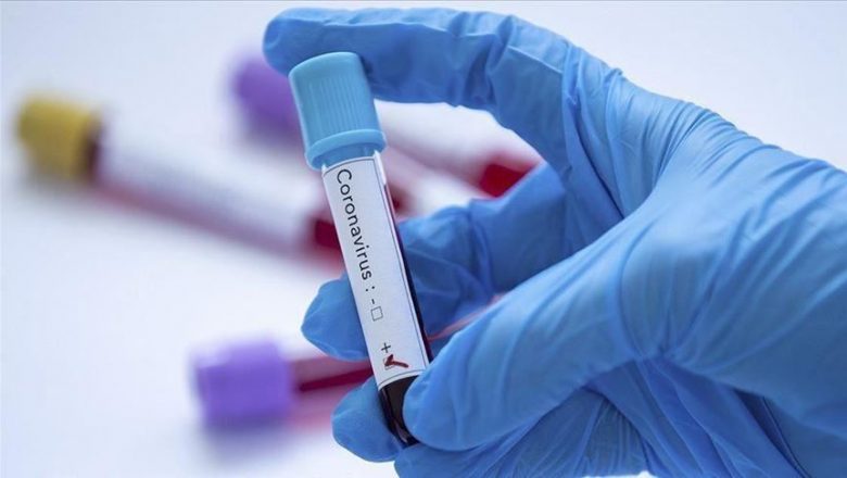 100 cas positifs de coronavirus détectés chaque jour. journaldebrazza.com