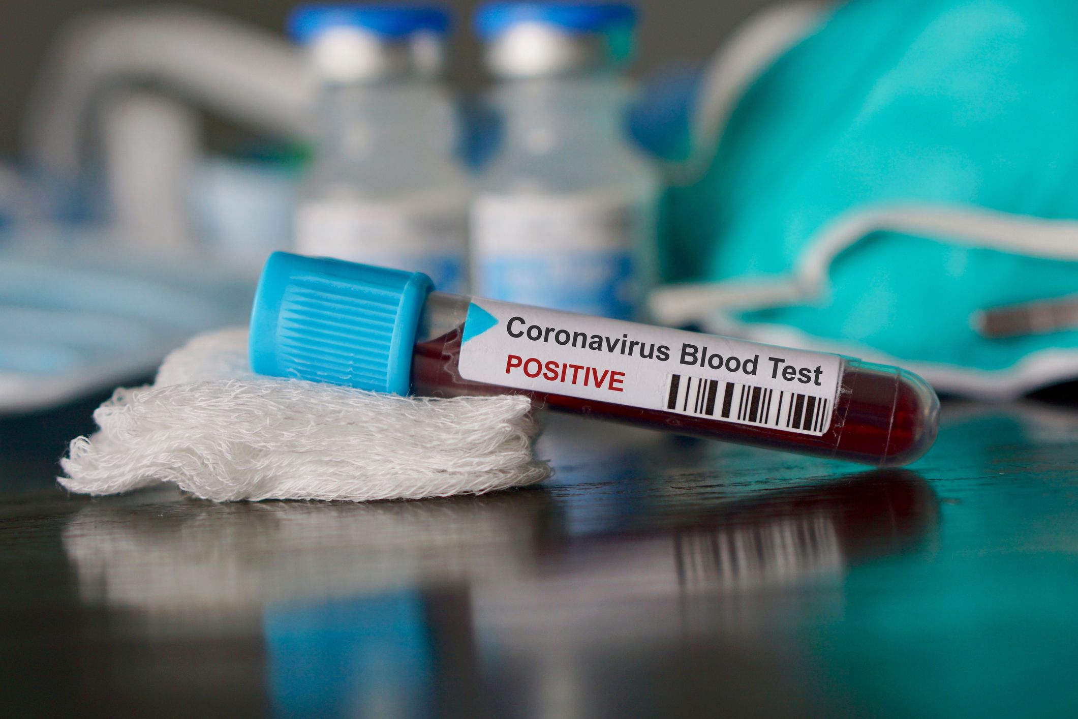 Coronavirus : le Congo enregistre 23.967 cas infectés