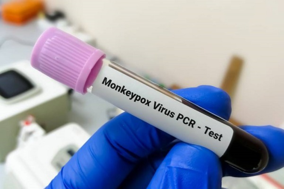 Maroc : nouveau cas confirmé de variole du singe