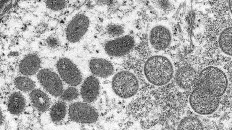 Afrique : 524 cas de variole du singe confirmés