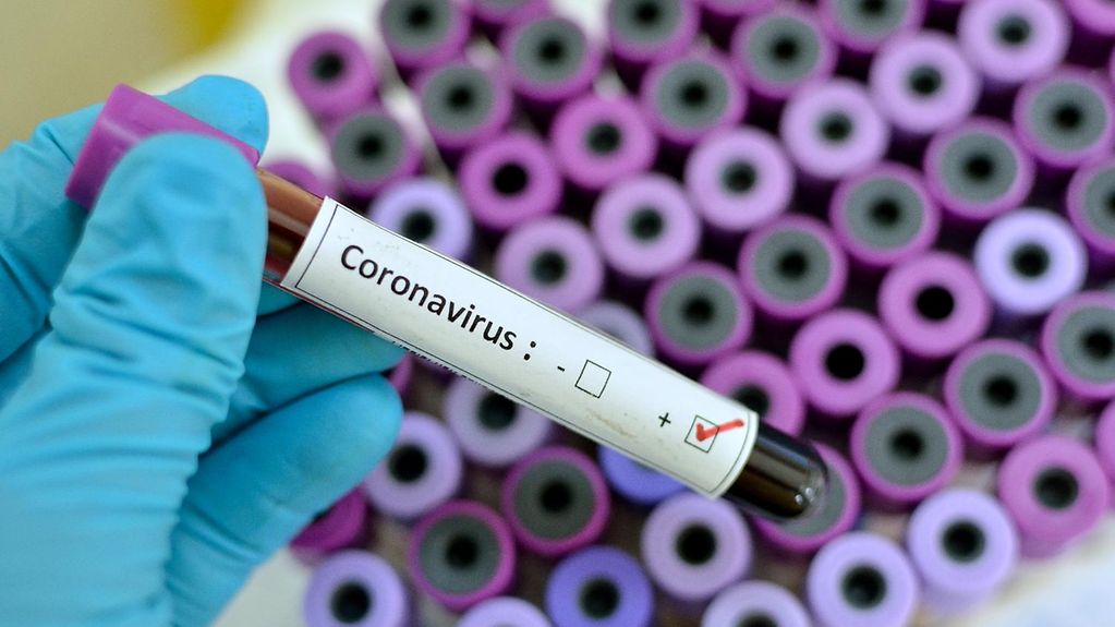 Congo-coronavirus : le président appelle la population à la vigilance